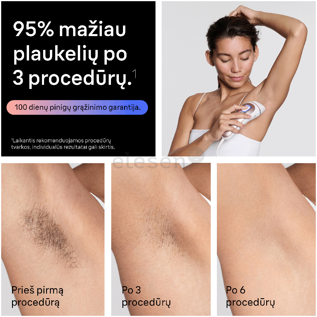 Braun Skin i·expert, белый/розовый - Фотоэпилятор