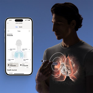 BeamO, белый/черный - Устройство для контроля показателей здоровья 4 в 1